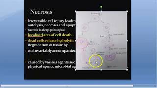 Pathology 045 b Necrosis Type Coagulative Liquefaction Caseous Fat Fibrinoid Tombstone Cheese [upl. by Denby269]