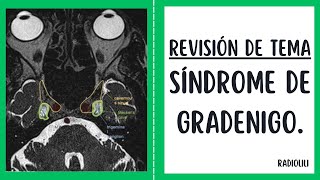 Revisión de Tema 55 Síndrome de Gradenigo [upl. by Champaigne243]