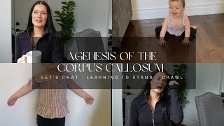 Agenesis of the Corpus Callosum  Let’s Chat  Learning to Stand  crawl [upl. by Aniral]