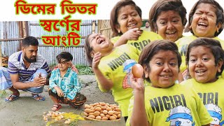 ডিমের ভিতর স্বর্ণের আংটি।ছোট দিপু 2023 সালের প্রথম ভিডিও।Chotu Dipu Comedy 2023।New Funny Video 2023 [upl. by Resee]