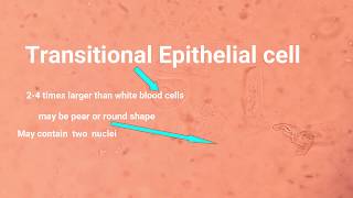 Epithelial cell types and its identification [upl. by Hakon]