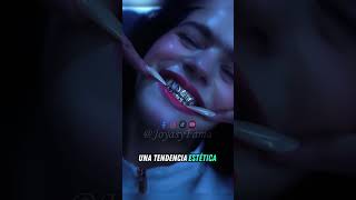 La Rosalia y los dientes de Oro de alto Valor 🔥 rosalia joyas famosos viral shorts [upl. by Roland532]