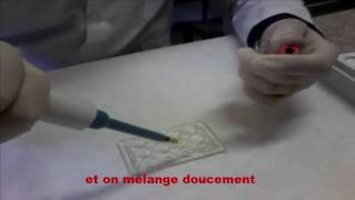 test VDRL Veneral Disease Research Laboratory sur biologie ma vie [upl. by Mahda]