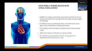 Atrial Fibrillation AFib [upl. by Tareyn]