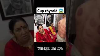 ‪souravjoshivlogs7028‬ ​na Cup thyroid kara Li 😱 trending [upl. by Zacharias]