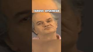 Tardive Dyskinesia [upl. by Eelaroc]