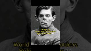 Disfigured World War One Soldiers Before and After 👀 ww1 warshorts warhistory disturbing [upl. by Ecnaralc]