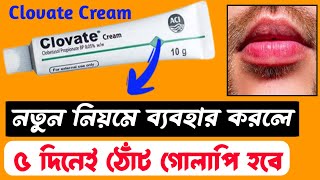 Clovate Cream For Lips ৫ দিনেই ঠোঁট গোলাপি হবে 😱 ঠোঁট গোলাপি করার ক্রিম। How To Get Pink Lips [upl. by Amory493]