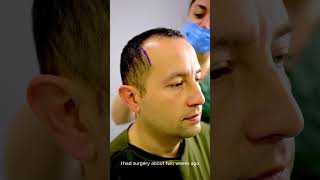 Hair transplant Saç ekimi haartransplantation hairtransplant prp [upl. by Lanni]