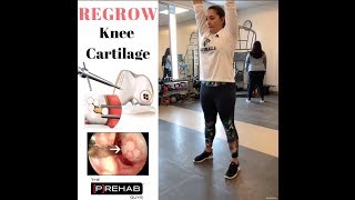 Repairing Knee Cartilage with an OATS Procedure [upl. by Edya]