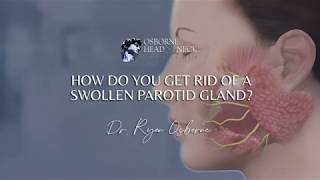 How do you get rid of a swollen parotid gland [upl. by Aivilo765]