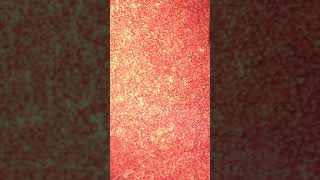 Microfilaria in a blood sample taken from a dog [upl. by Aderb]