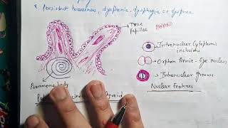 Papillary Carcinoma of Thyroid Pathology [upl. by So]