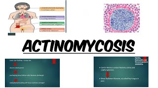 ACTINOMYCOSIS  IMAGES  MCQs [upl. by Nospmis733]