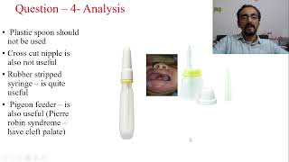 How to feed the baby with cleft palate  neonatology part  3 [upl. by Lenni]