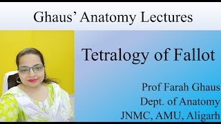 Tetralogy of Fallot [upl. by Grimbal]