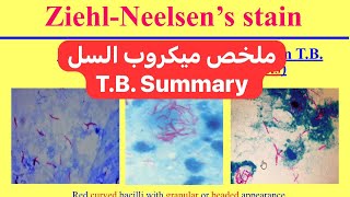 ملخص ميكروب السل Mycobacteria TB Summary [upl. by Sparky669]