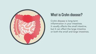 Crohn Disease Signs Symptoms Causes and Treatment  Merck Manual Consumer Version [upl. by Josy]