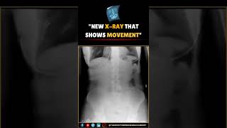 Low Radiation amp Fast Results The Breakthrough of Moving XRays [upl. by Thunell]