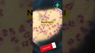 High neutrophil count in peripheral smear  neutrophils  CBC  Causes of Neutrophilia  hematology [upl. by Warring]