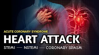 Types of Heart Attack  STEMI NSTEMI Unstable angina  Acute Coronary Syndrome [upl. by Hampton672]