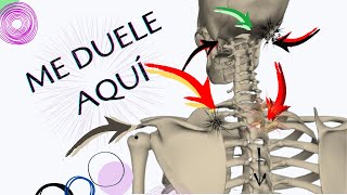 👉¿DÓNDE duele por problemas de la CERVICAL ↭↭↭↭꧁꧂ [upl. by Ahsenid475]