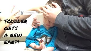 TODDLER EAR WAX REMOVAL [upl. by Etteraj]