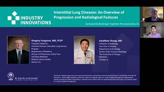 Interstitial Lung Diseases An Overview of Progression and Radiological Features [upl. by Trela]