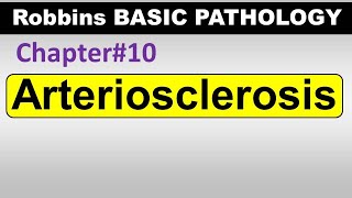 Ch10  Arteriosclerosis  Blood Vessel Pathology  Robbins Lectures [upl. by Aramad]