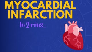 Myocardial Infarction in 2 mins [upl. by Paulo]