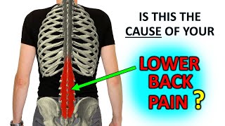 Recurrent Lower Back Pain The Research Says… Do This [upl. by Hakeber]