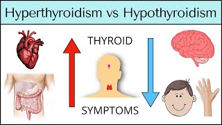 Hyperthyroidism vs Hypothyroidism Symptoms MADE EASY Thyroid Explained [upl. by Karrah]