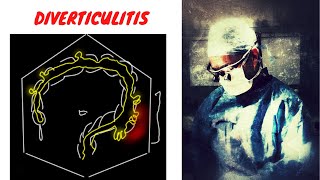 DIVERTICULITIS EXPLAINED [upl. by Selle]