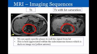 Introduction to Radiology Magnetic Resonance Imaging [upl. by Omsare278]