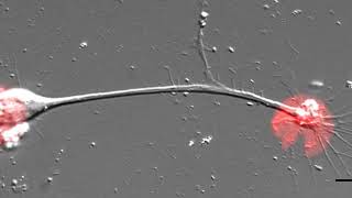 Cytoskeletal Mechanisms of Axonal Contractility [upl. by Netneuq909]