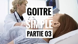 Goitre Simple  partie 03 [upl. by Derrick]