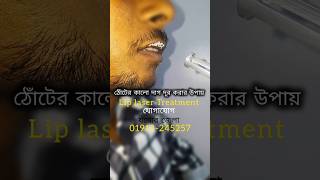 Lip laser treatment shortvideo jessore lasertreatment [upl. by Karoline473]