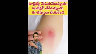 టాబ్లెట్స్ ఇలాగే వేసుకోవాలని తెలియక తప్పు చేశా healthtips doctor medicalprofession paramparik [upl. by Nnaharas]