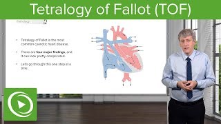 Tetralogy of Fallot TOF – Pediatrics  Lecturio [upl. by Rochkind]