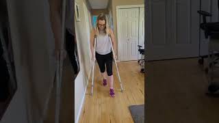 My Healing Journey  Tibial Plateau Fracture  Week 8 [upl. by Liberati]