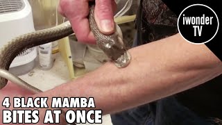 Surviving A Black Mamba Snake Bite  Venom Man [upl. by Anirrak]