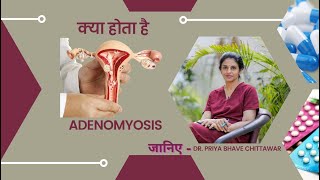 क्या होता है Adenomyosis जानिए Dr Priya Bhave Chittawar [upl. by Notgnirra]