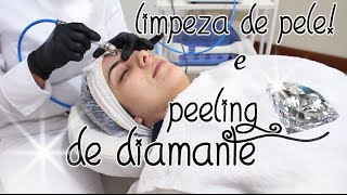 Benefícios do PEELING DE DIAMANTE e LIMPEZA DE PELE [upl. by Renado486]