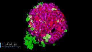 iPSC Derived Neuronal Spheroids [upl. by Marquita]