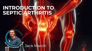 Introduction To Septic Arthritis [upl. by Essilec85]