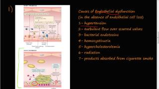 53  Thrombosis Virchows triad Endothelial Injury [upl. by Bernj]