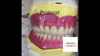 Protezat e dhëmbëveDentures [upl. by Nerok]