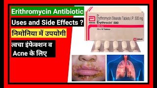 Erythromycin Tablet  Erythromycin Oral Suspension  Erythromycin 250 Uses [upl. by Eerased]