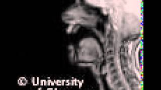 MRI voiceless palatoalveolar click [upl. by Nhaj]