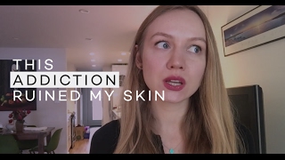 This Addiction Ruined My Skin  28 Days Of Clear Skin [upl. by Anairol]